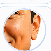 cheek